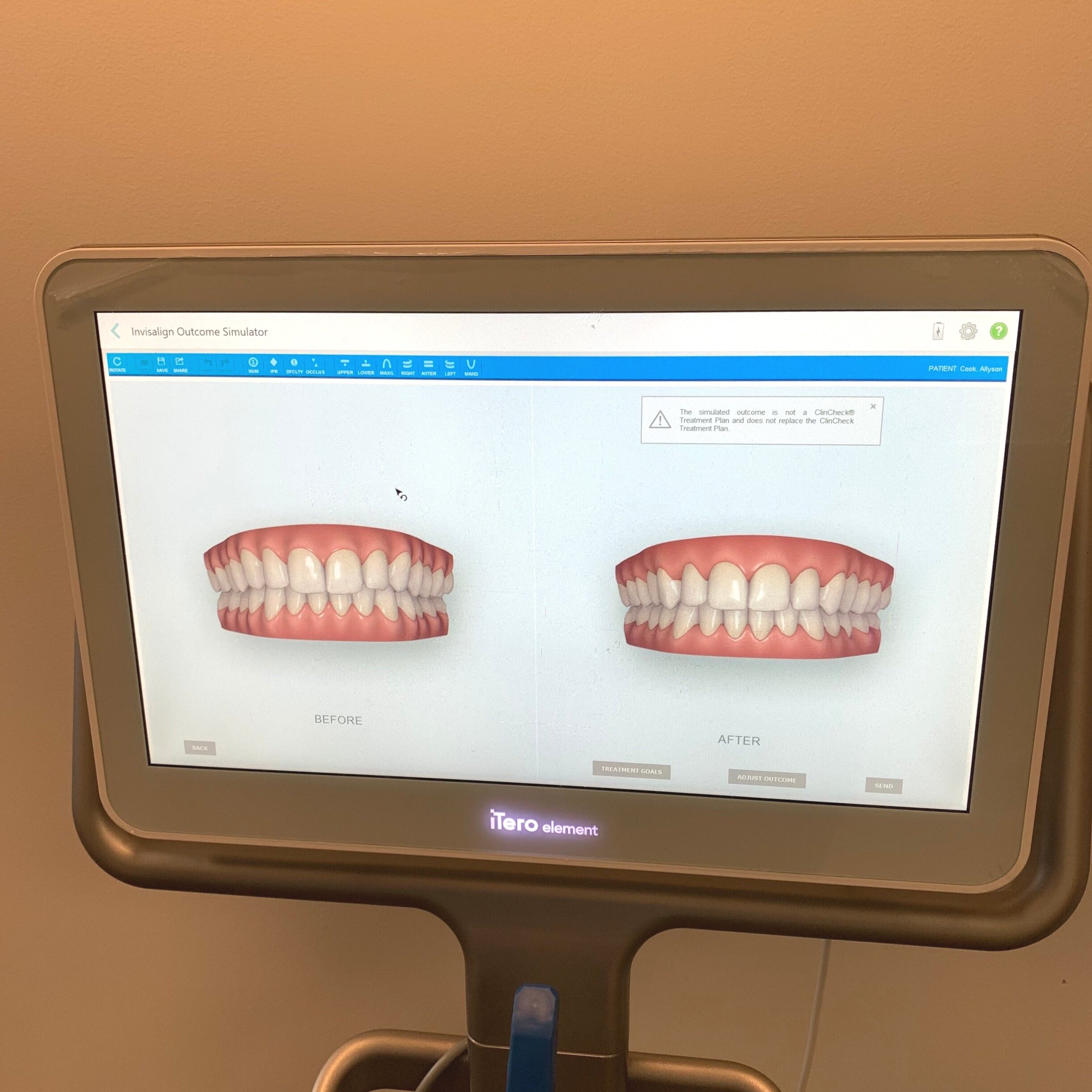 Invisalign  Route 9 Dental