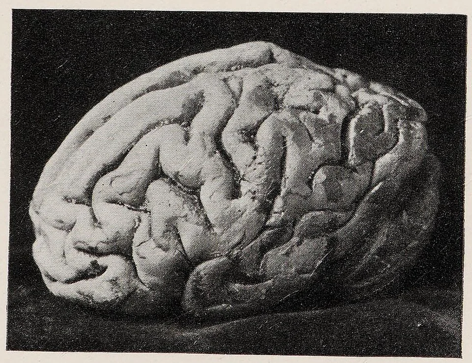 Brain Rot and Mental Clutter: How to Reclaim Your Attention