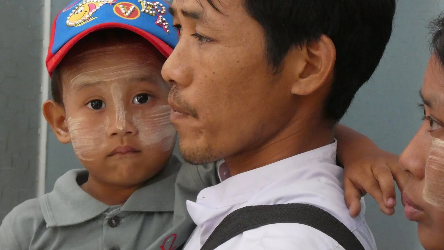 A cochlear implant enables Min Thit Phyo to hear