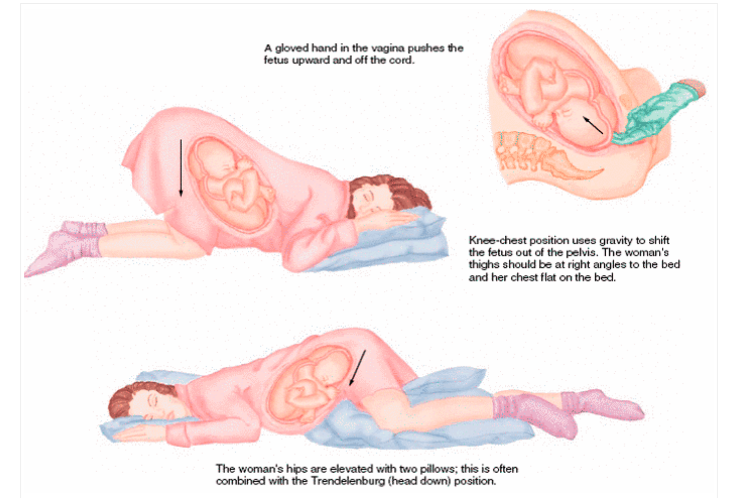 чем опасен оргазм при беременности во сне фото 15