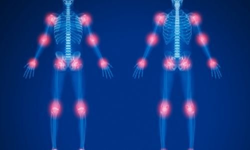 how to regrow knee cartilage naturally vitamin c glutathione Best Foods for Healing and Joint Recovery Nourish and Move: A Nutrigenomic
