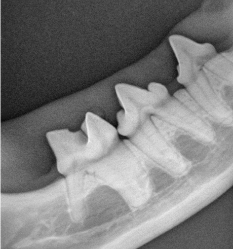 Ben Tooth xray.png