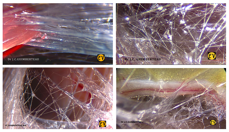 Photos by Dr. Jean-Claude Guimberteau, from the Fascia Research Congress website here: https://fasciacongress.org/2018-congress/2018-program/2018-special-events/ .