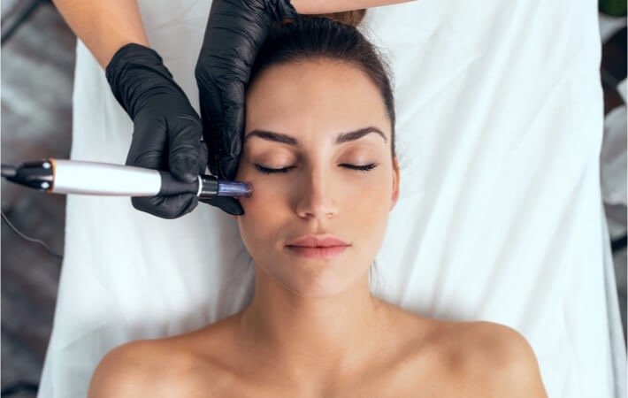 Microneedling vs. Other Treatments: What Makes It Different?