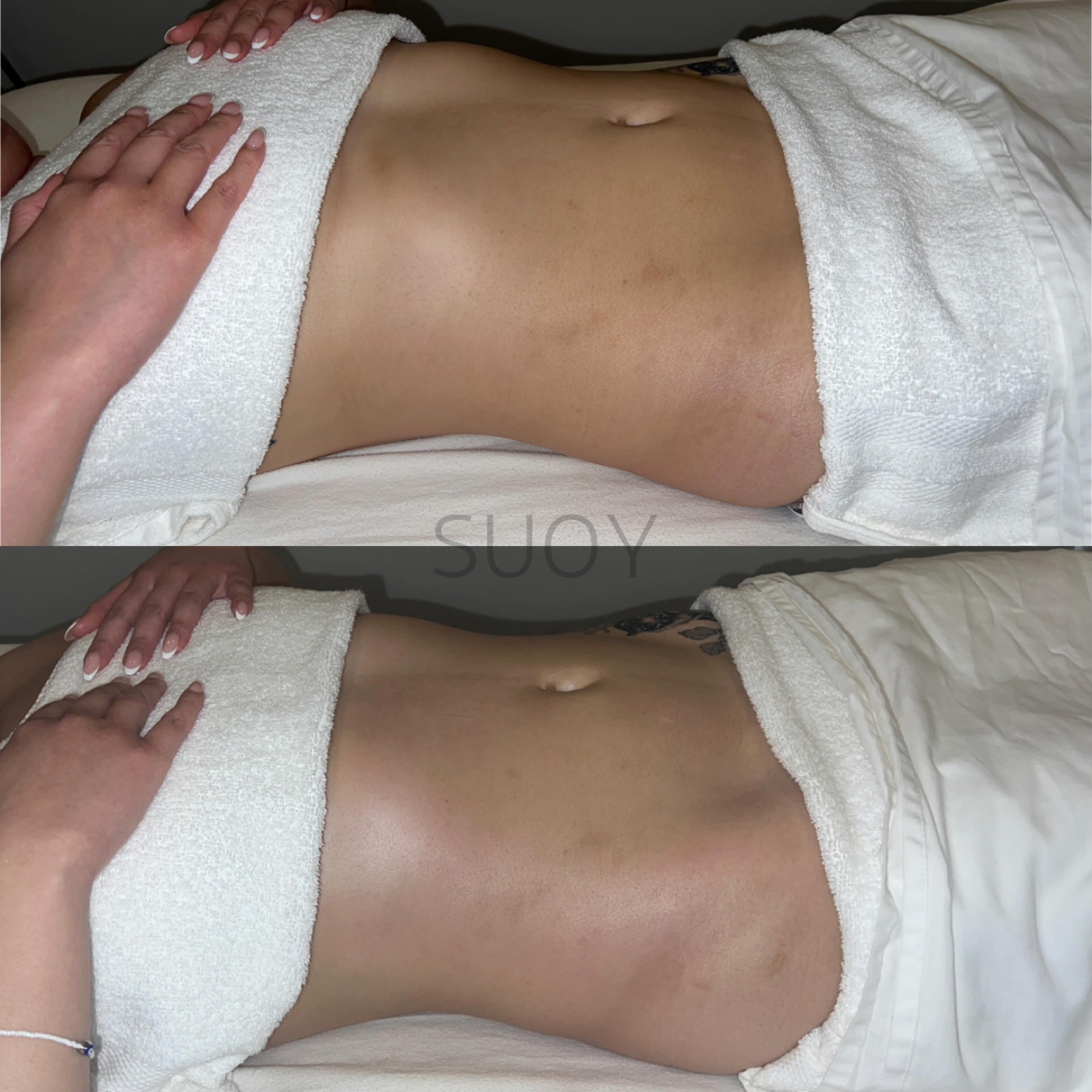 Brazilian Body Lymphatic Drainage Massage and Sculpting with techniques taught by Celebrity LMT Josie Rushing. 

Look what 50MINS can do! Top is before, bottom is after. 

We work on the WHOLE body! For us, this is more for health benefits than it is