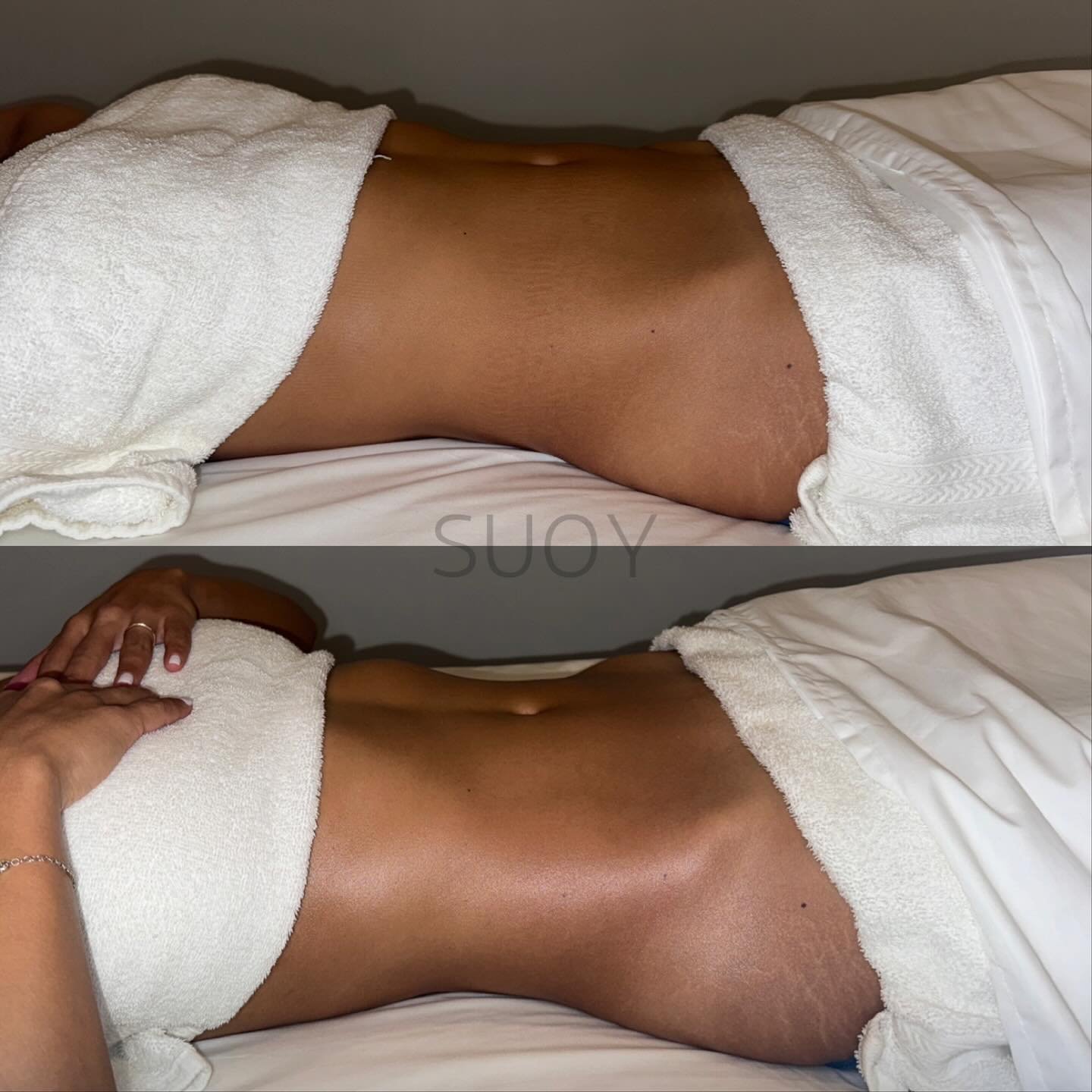 Brazilian Body Lymphatic Drainage Massage and Sculpting with techniques taught by Celebrity LMT Josie Rushing. 

Look what 50MINS can do! Top is before, bottom is after. 

We work on the WHOLE body! For us, this is more for health benefits than it is