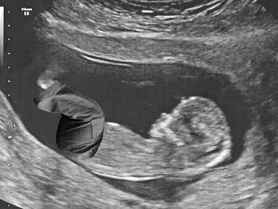 We interrupt this blog for a very important announcement