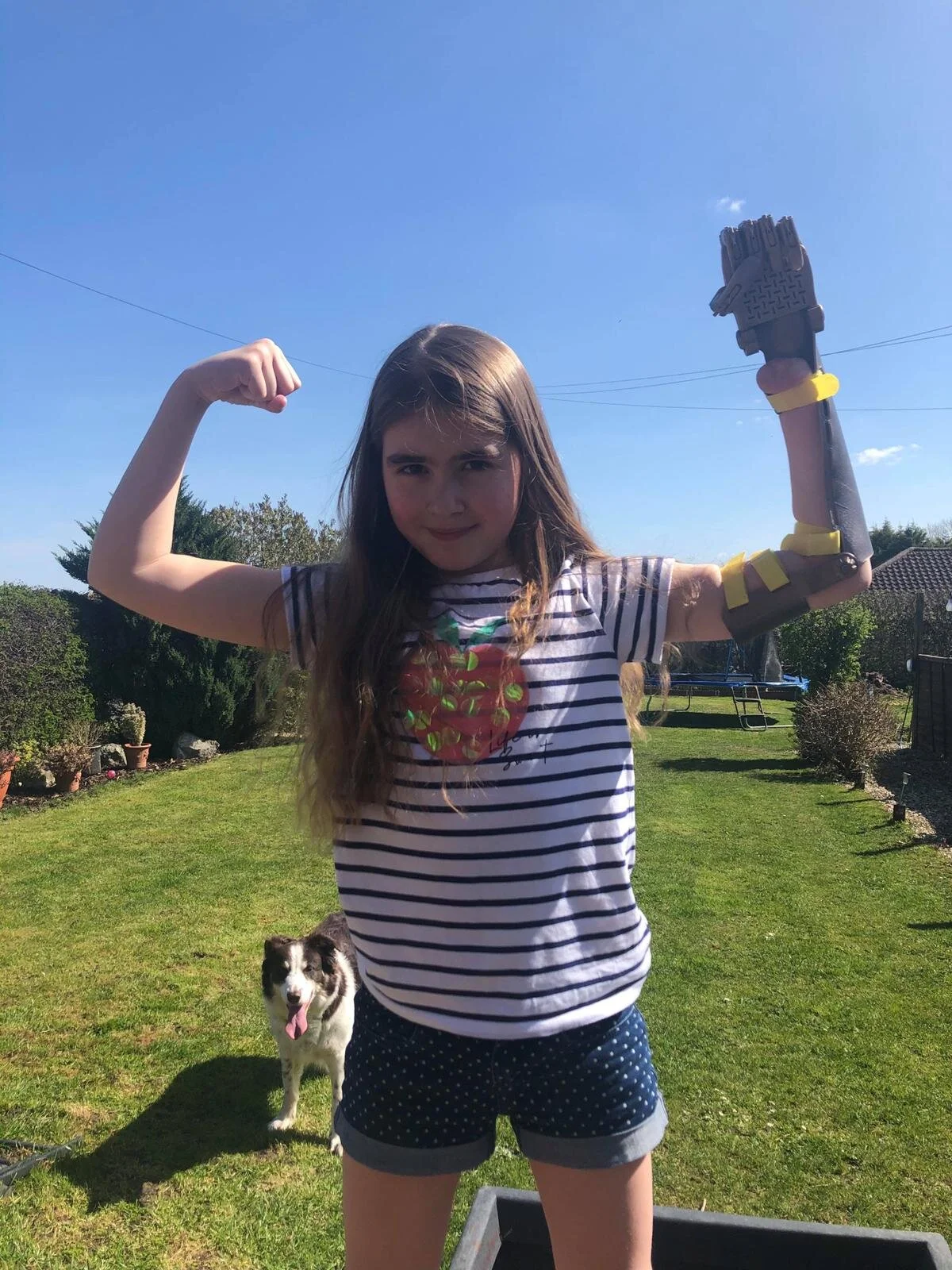 It’s Limb Difference Awareness Month!