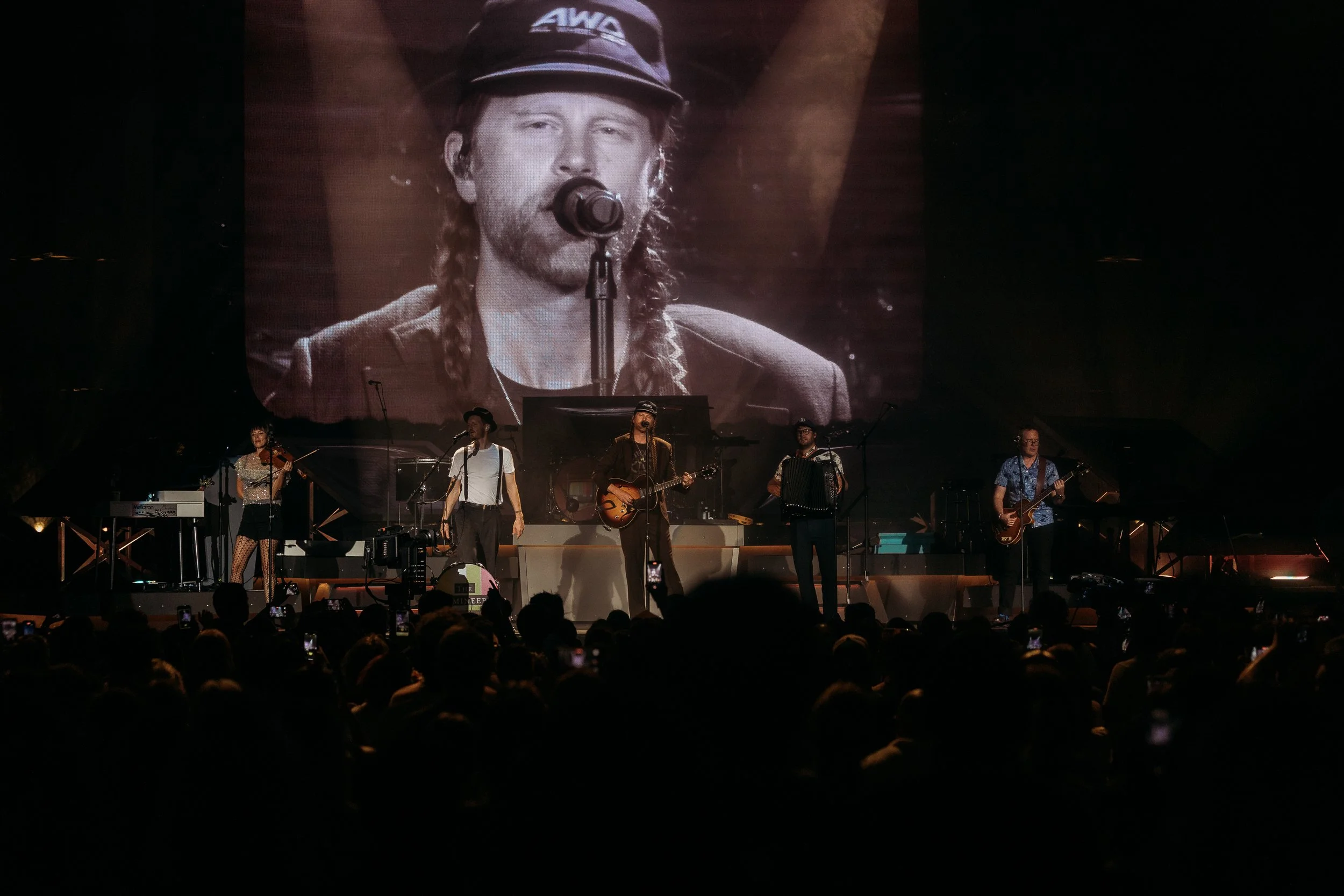 kg-lumineers-stl-7.jpg