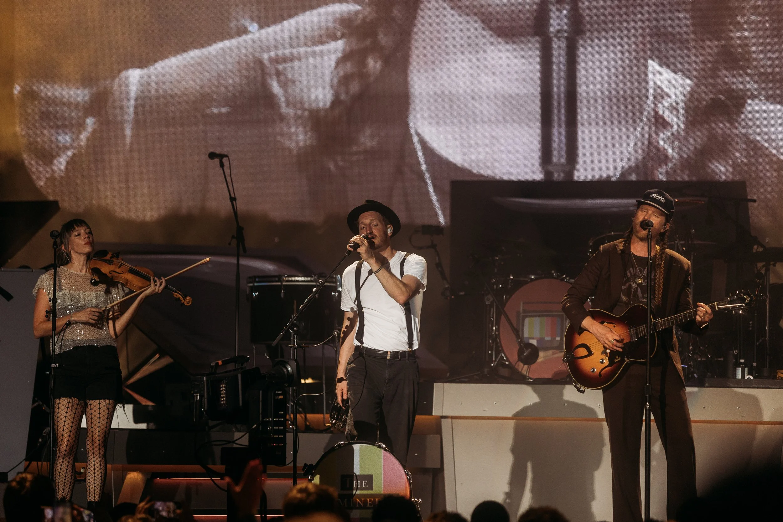 kg-lumineers-stl-11.jpg