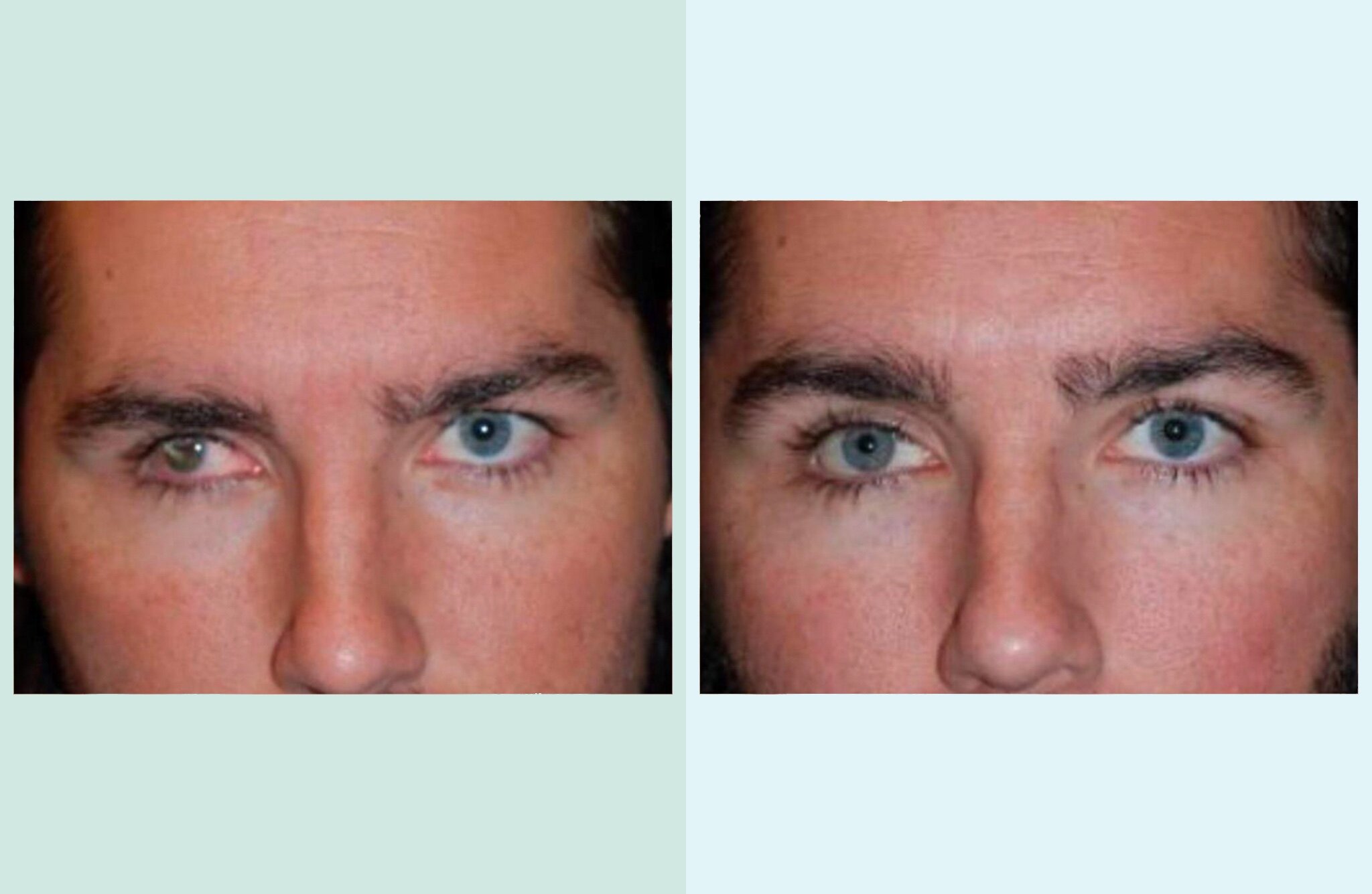 Dr. Chip Cole Oculus Plastic Surgery Atlanta GA