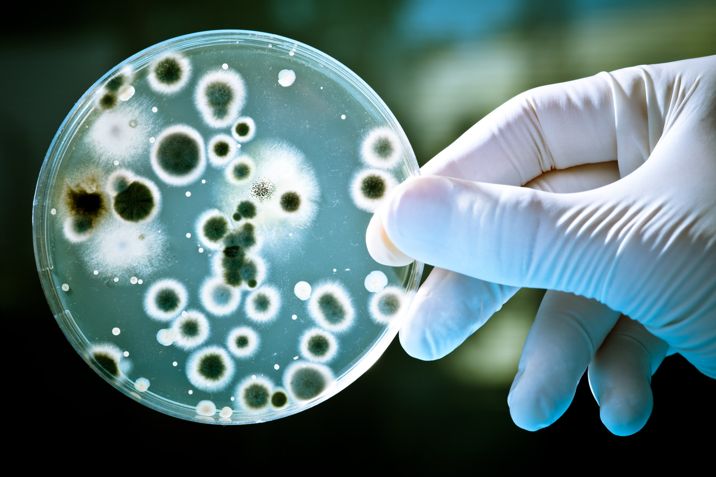 Control microbiológico