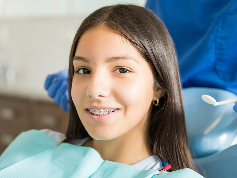 What Questions Should I Ask When Getting Braces?