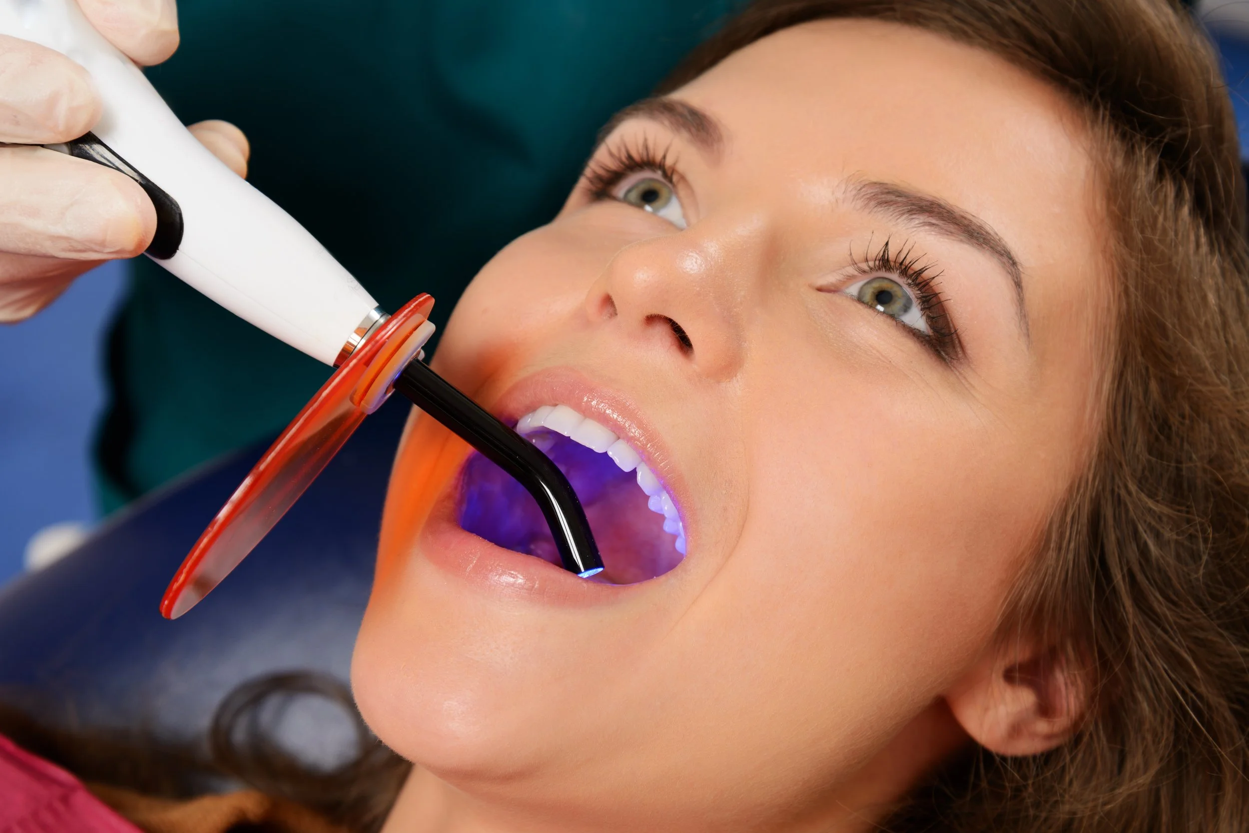 Dos and Don'ts After Getting a Dental Filling.