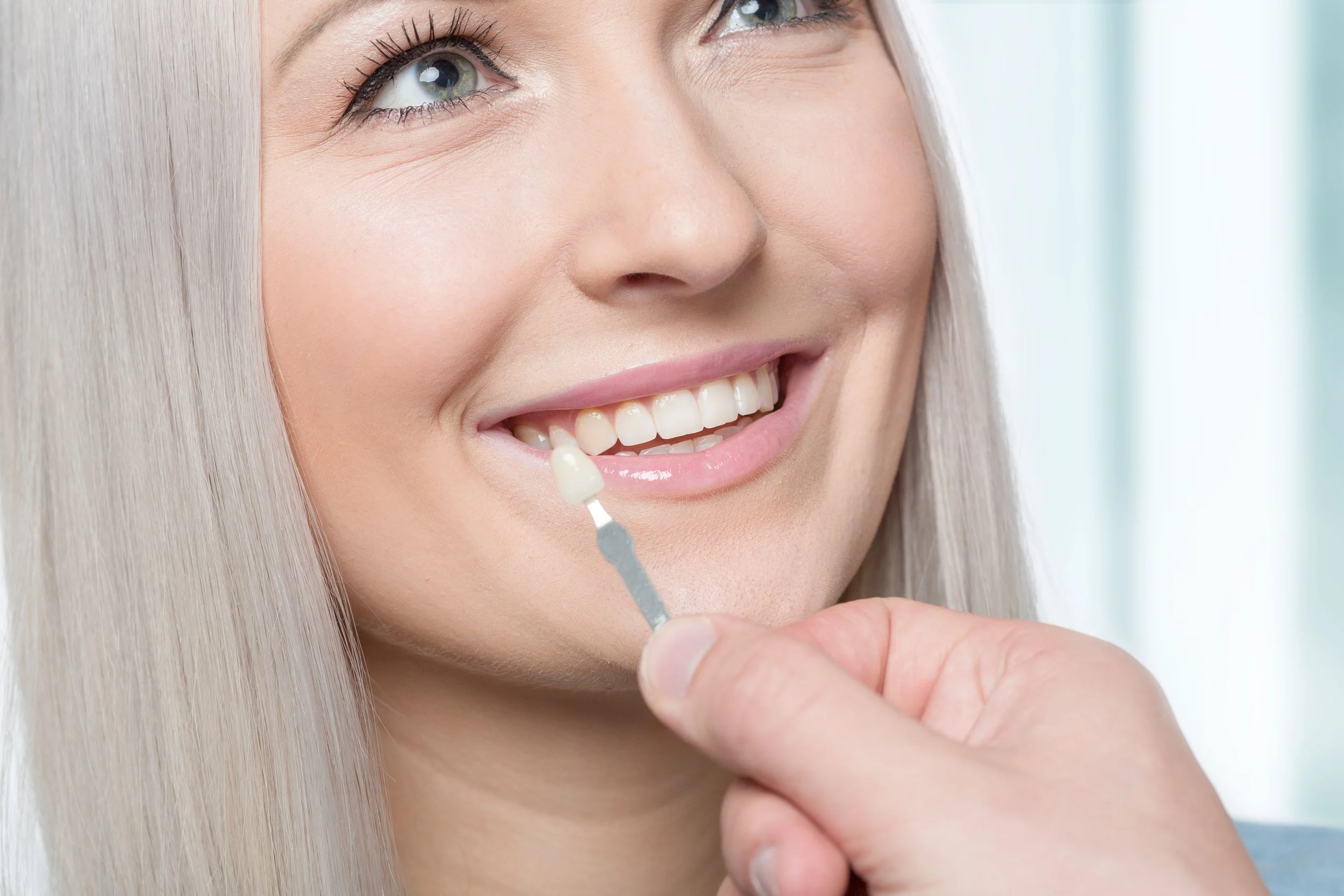 Can You Eat Normally With Veneers?