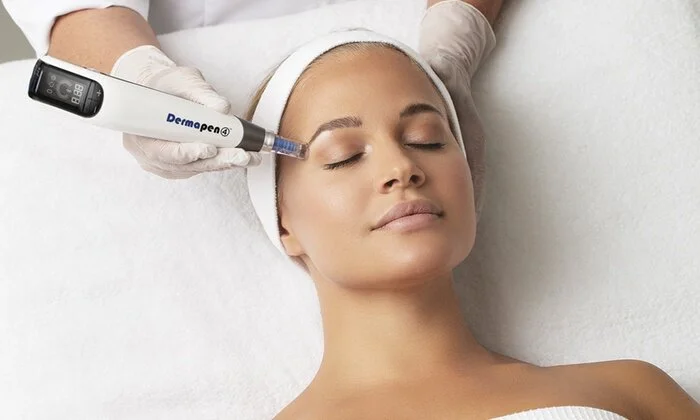 dermapen 7.jpg