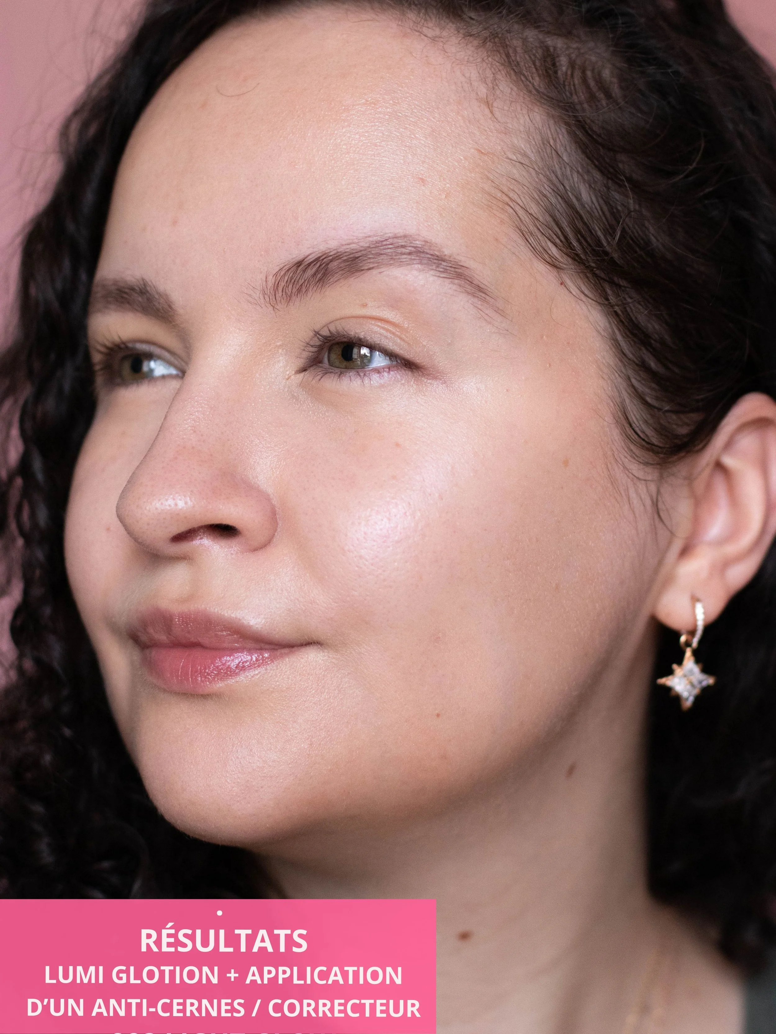 Zoom sur mon teint après l'application du Lumi Glotion en teinte 902 Light Glow de L'Oréal Paris ainsi que de l'anti-cernes Triclone Skin Tech Hydrating Concealer d’Haus Labs.