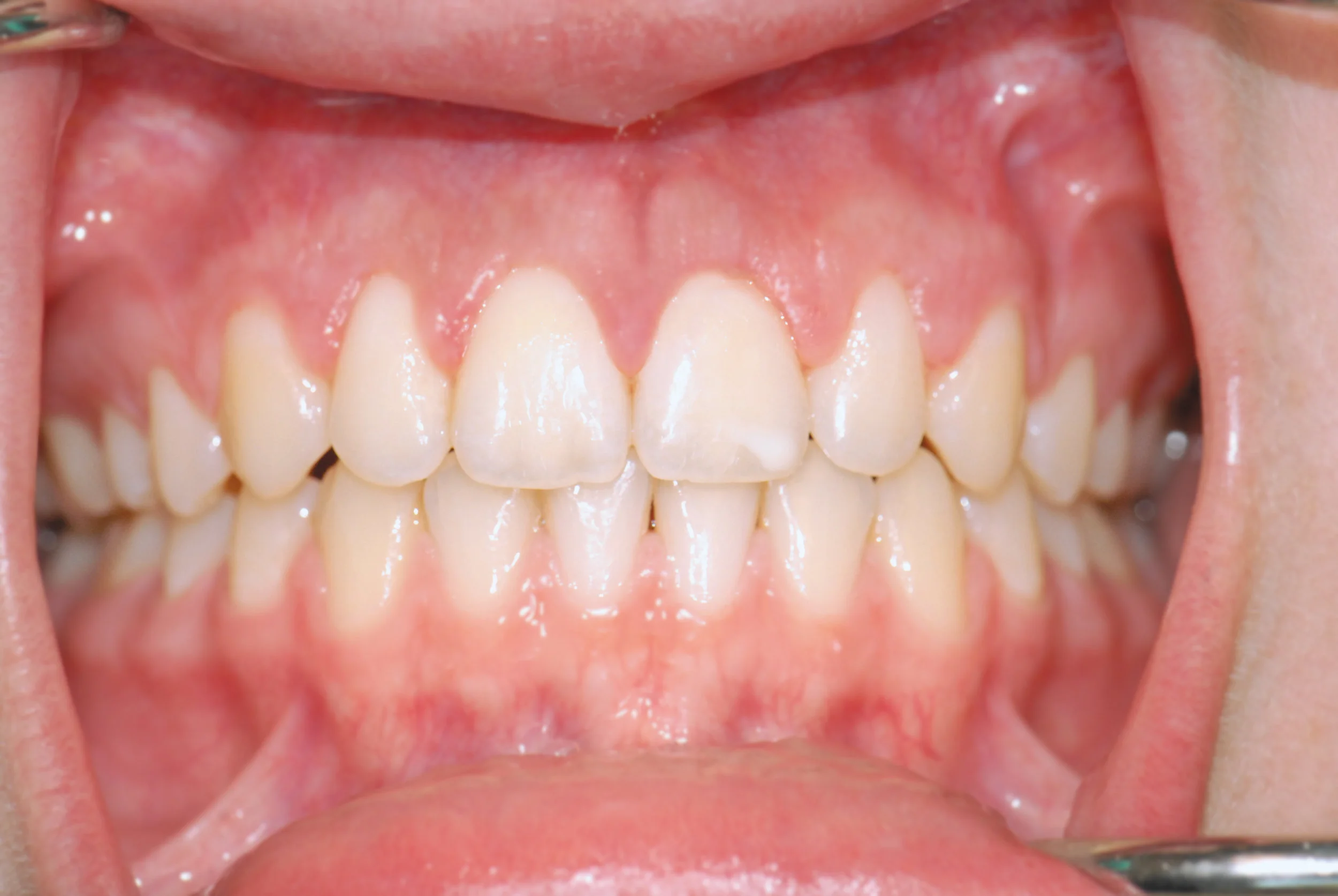 Work — Beaverton Periodontics