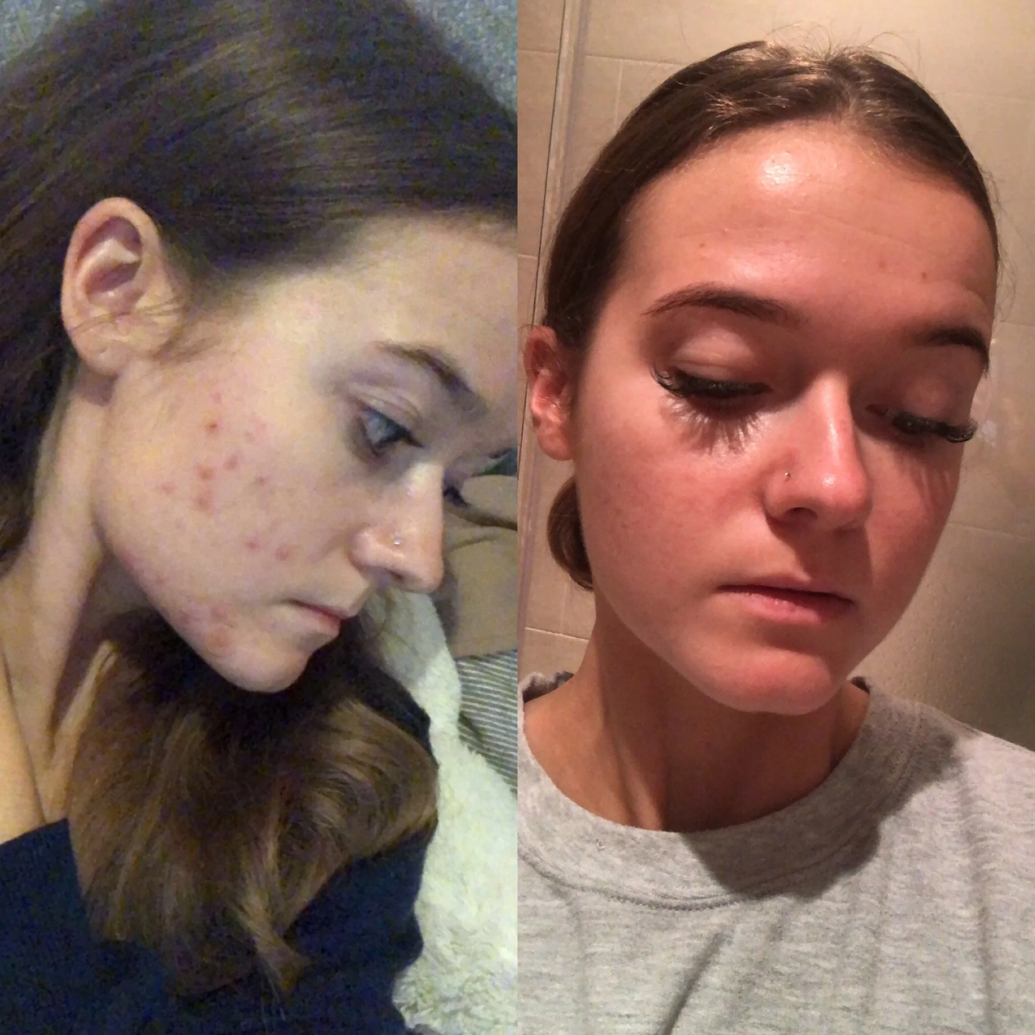 The skincare routine that has saved my skin