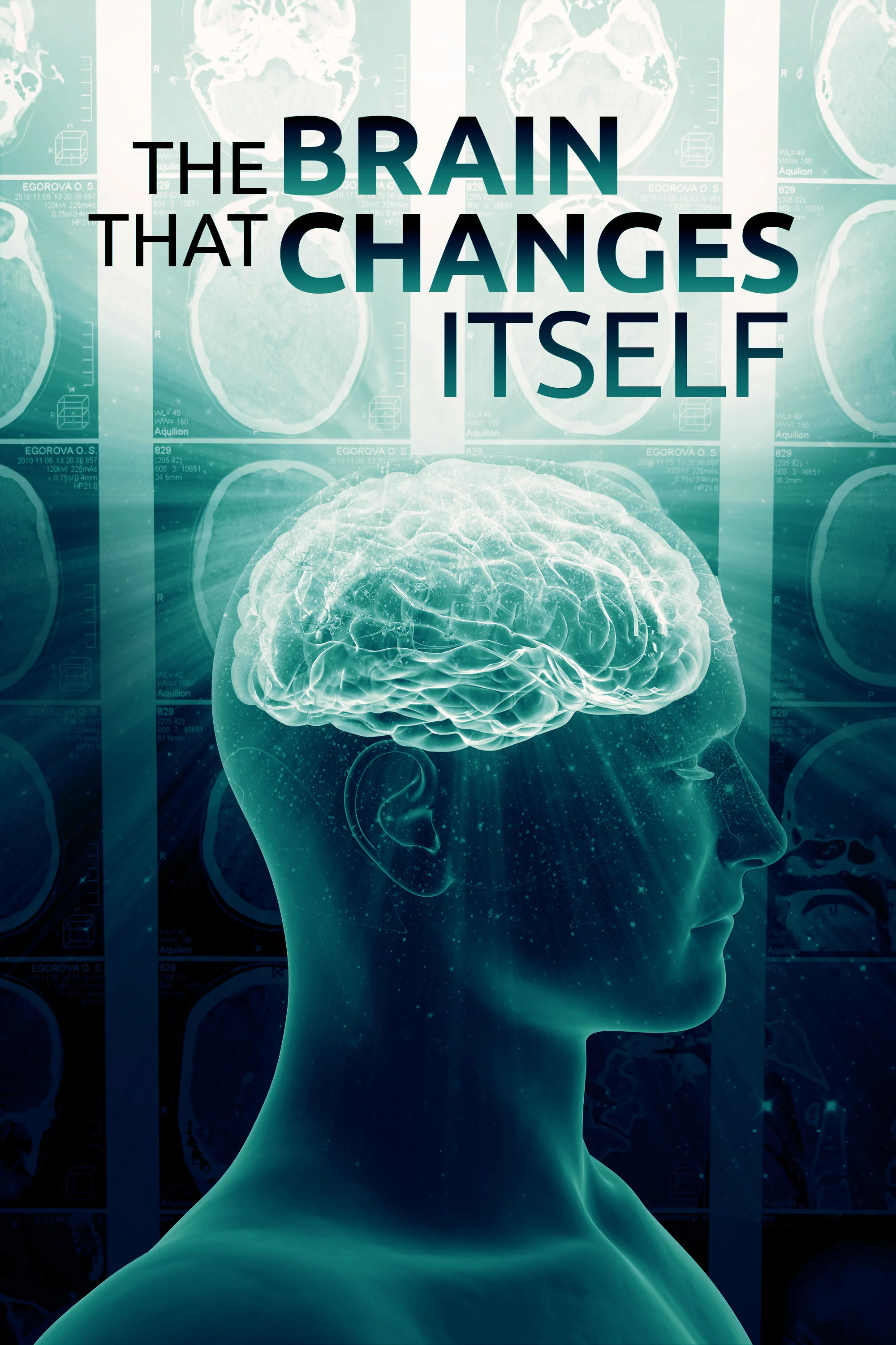 TheBrainThatChangesItself_cover_artwork_vertical.jpg