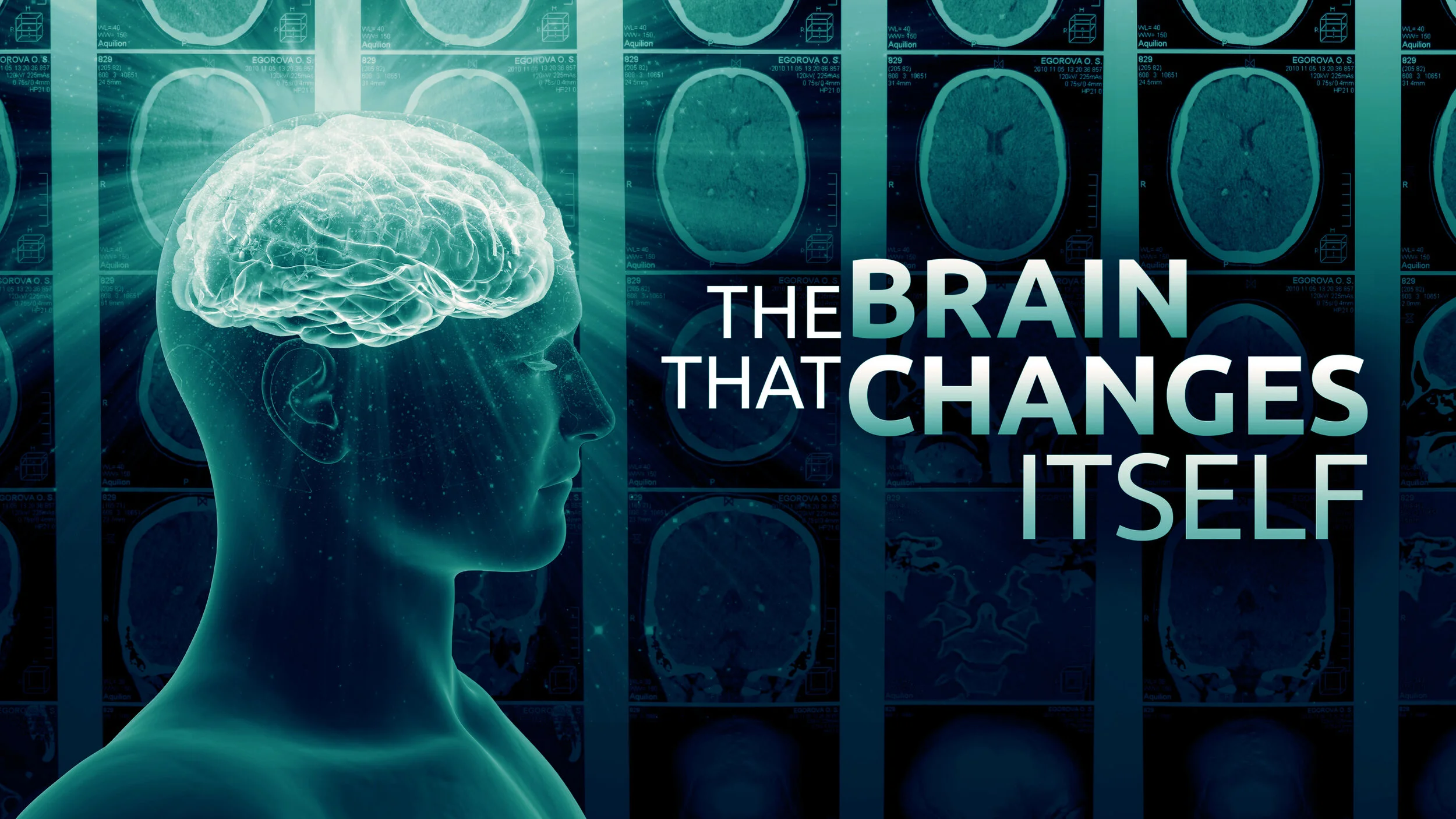 TheBrainThatChangesItself_4k.jpg