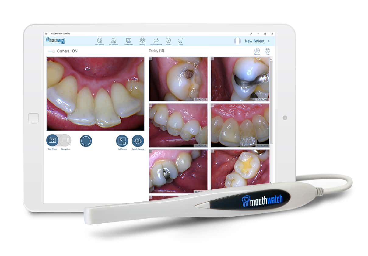 IntraOral Camera Dentistry & Orthodontics