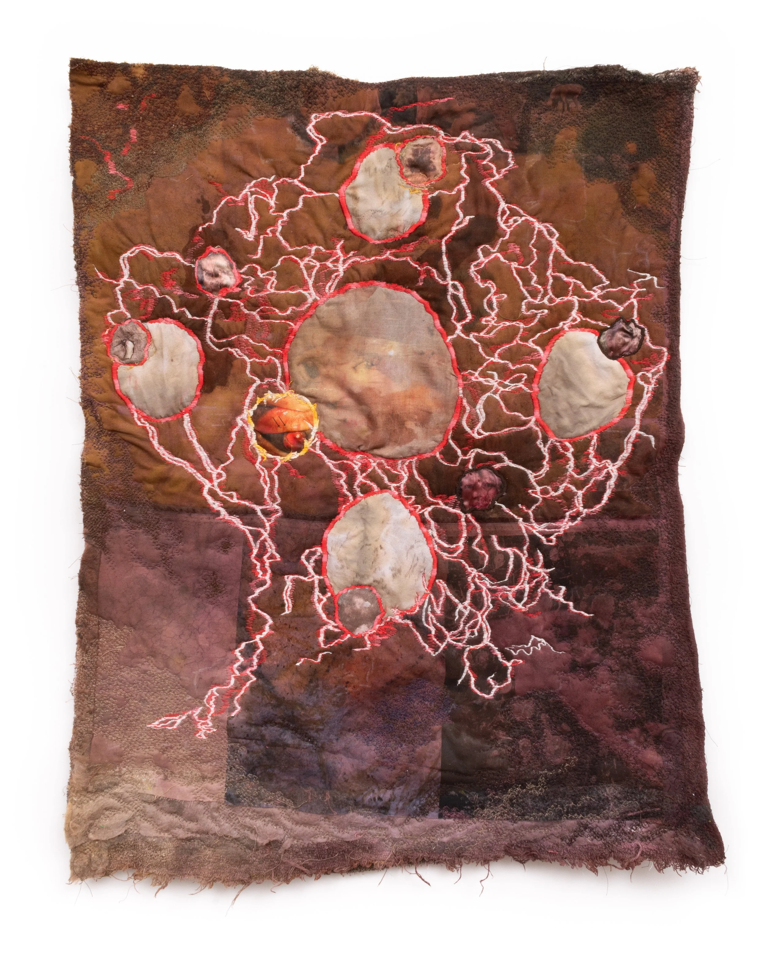 parasitic twins