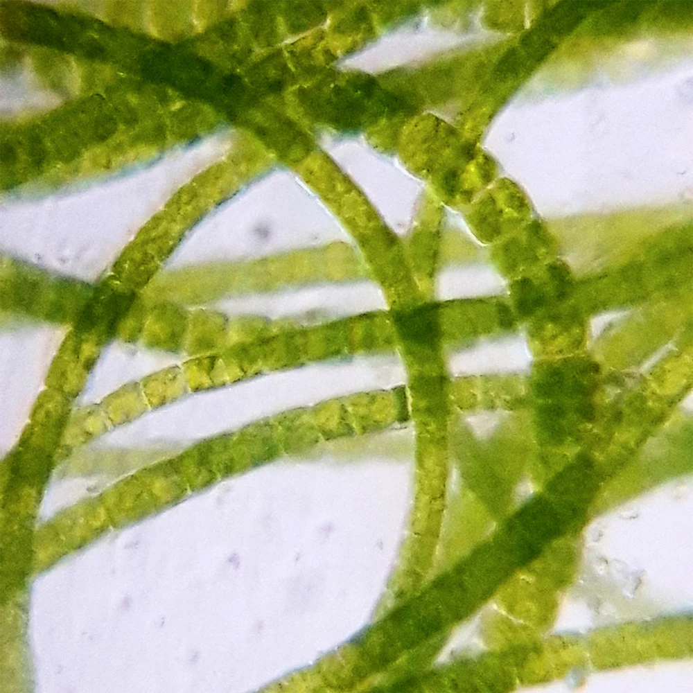 Figure 4. Filamentous Algae