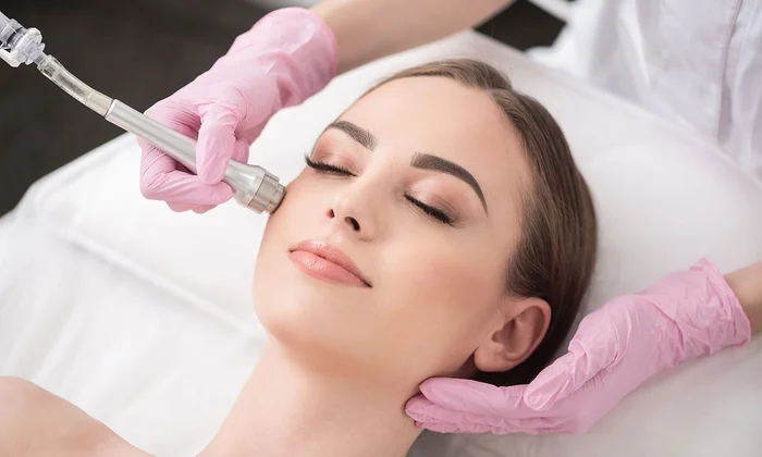 microdermabrasion.jpg