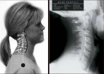 Normal-Cervical.jpg