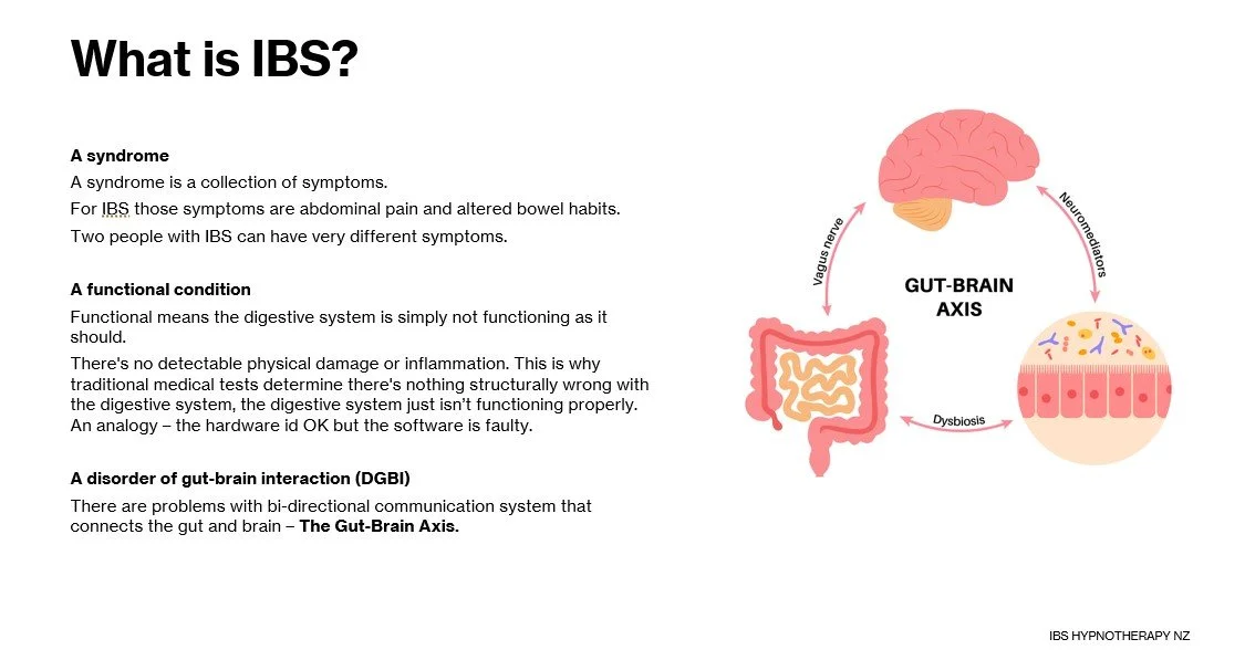 So what exactly is IBS?