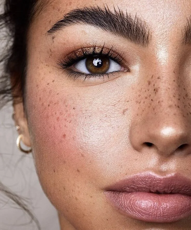 Freckles - #freckles.jpeg