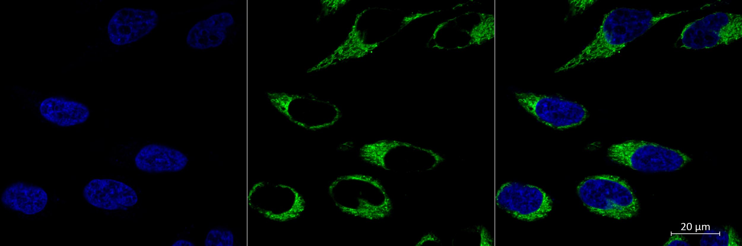 Cerrato_HeLa RhB 1uM_01.jpg