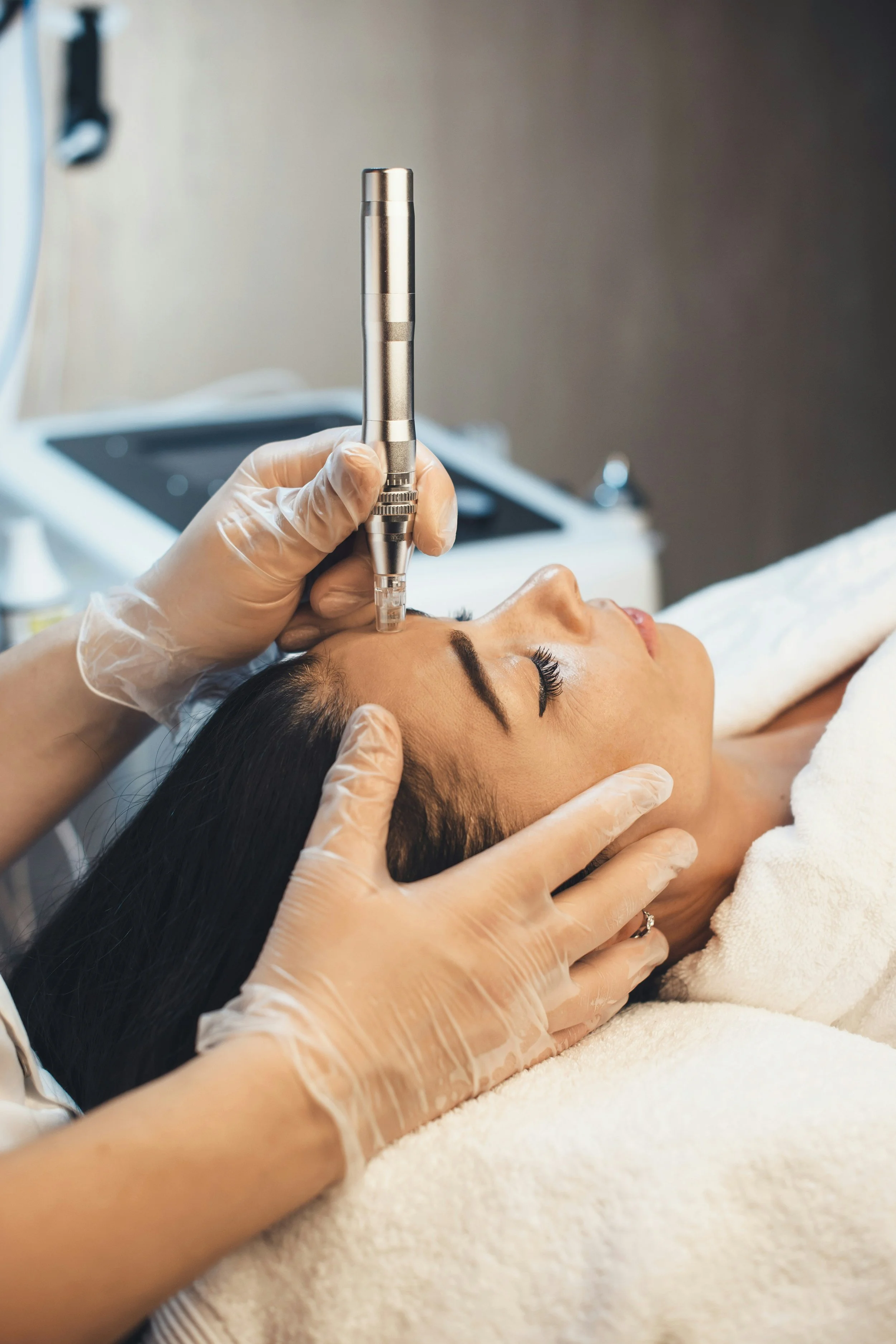 Microneedling