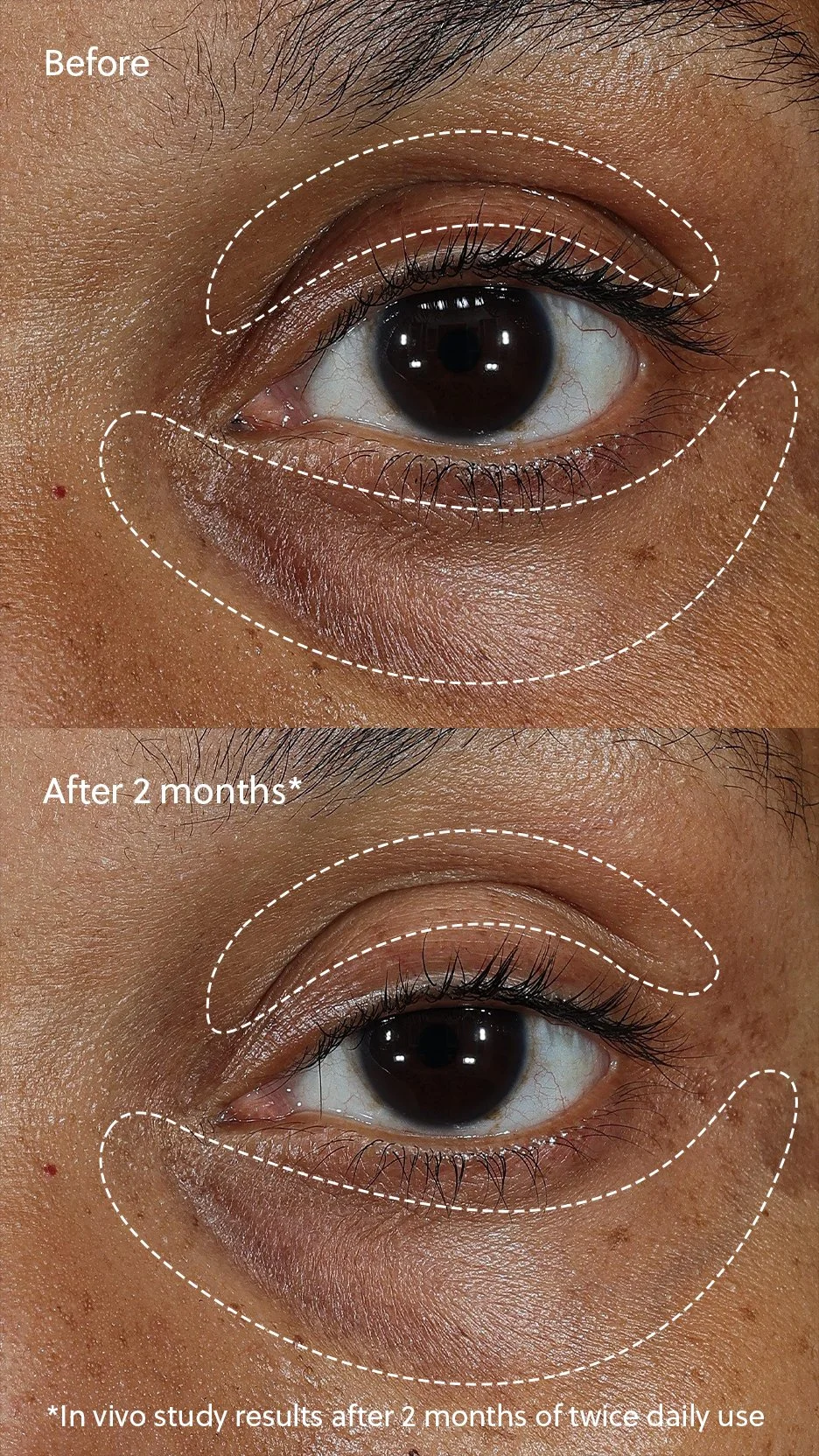 EM334-1334-vitamin-c-plus-eye-cream-pdp-social-before-after-1-1080x1920.jpg