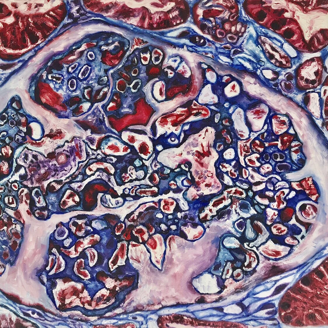 Glomerulus