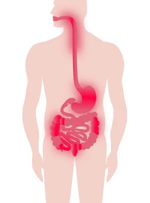 Crohn_s_Diagram_-_Matty_s_Diary_Blog_large.jpg