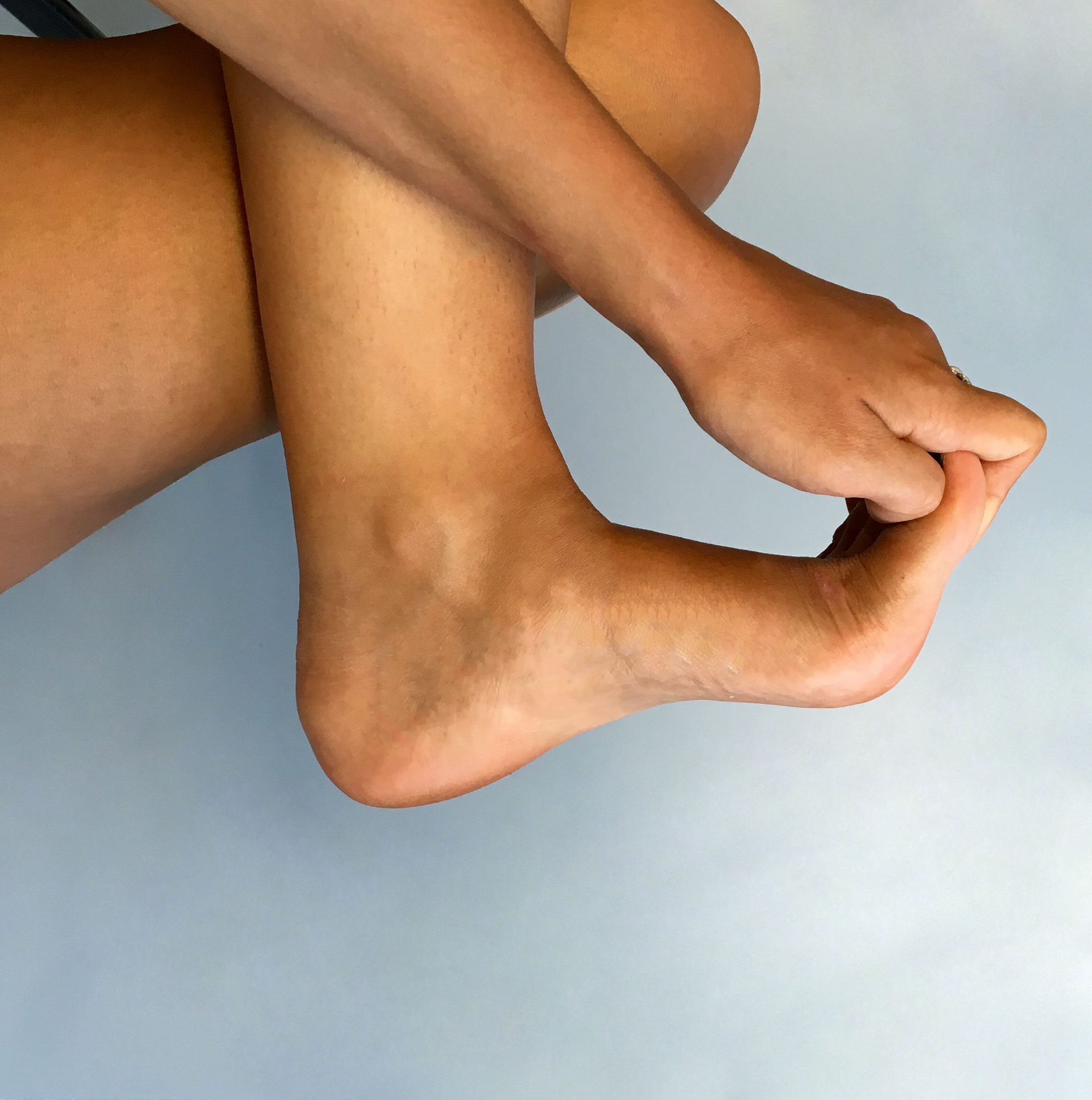 Stretches for plantar fasciitis — Fitzroy Foot and Ankle Clinic
