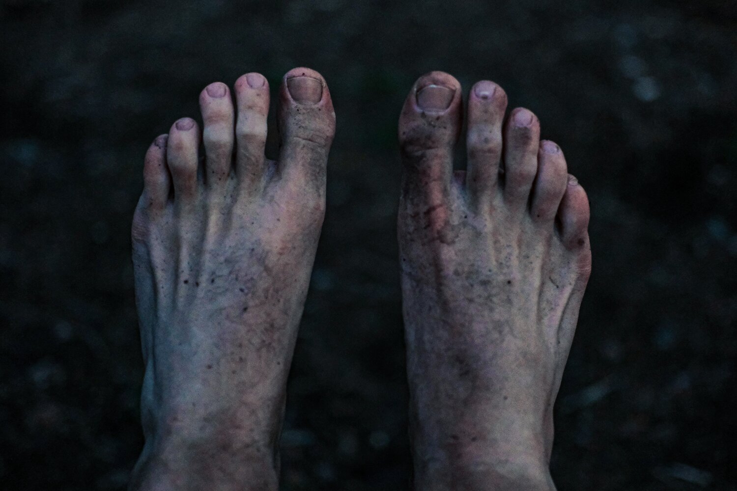 Fitzroy's Best Guide on How to Treat Ingrown Toenail — Fitzroy Foot and Ankle Clinic Fitzroy's Best Guide on How to Treat Ingrown Toenail — Fitzroy Foot and Ankle Clinic
