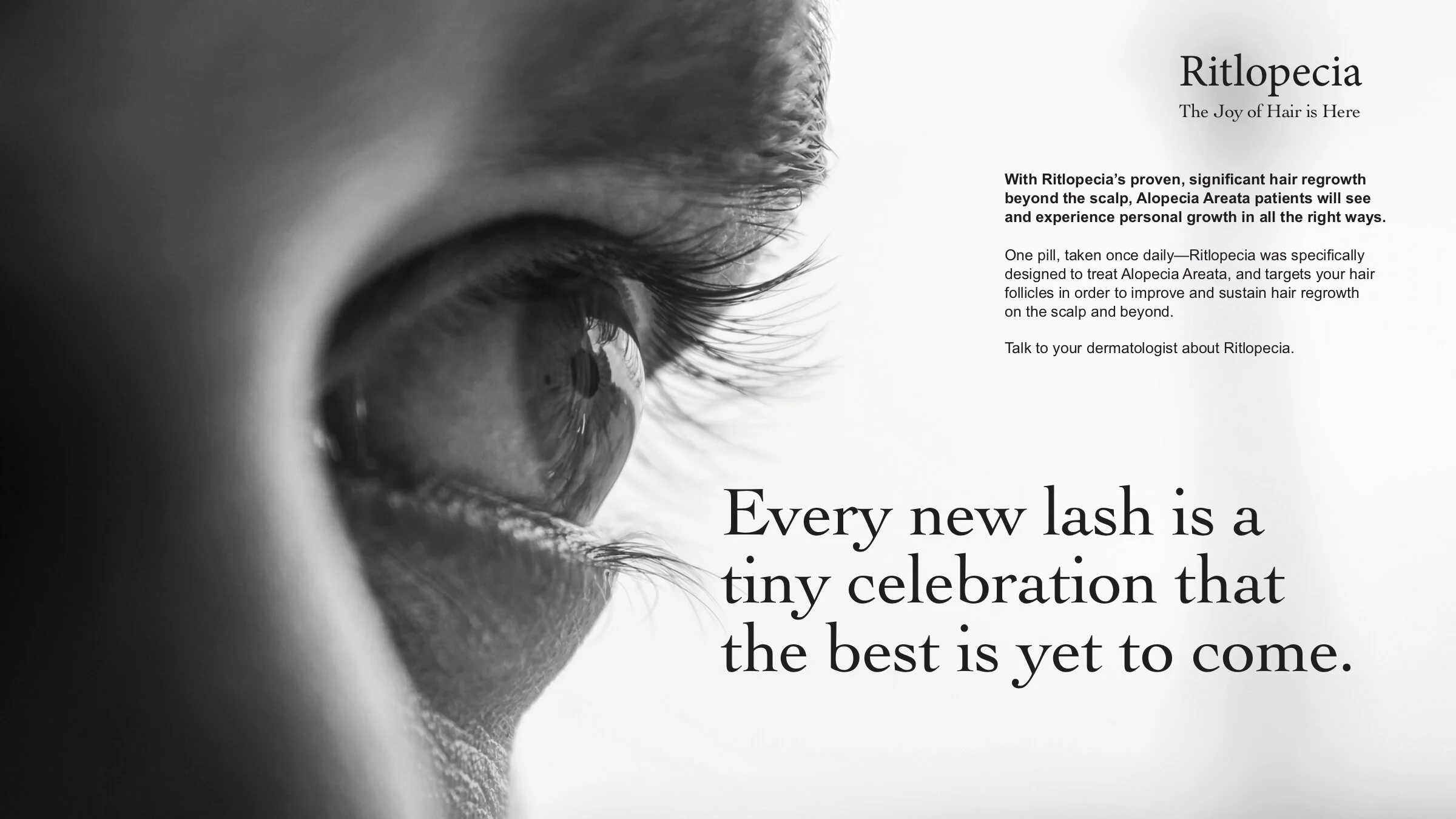 Lashes_Branded_Adlobs_CNMA_11_16.jpg