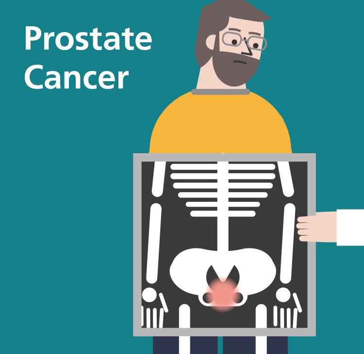 Irish Cancer Society Prostate Cancer