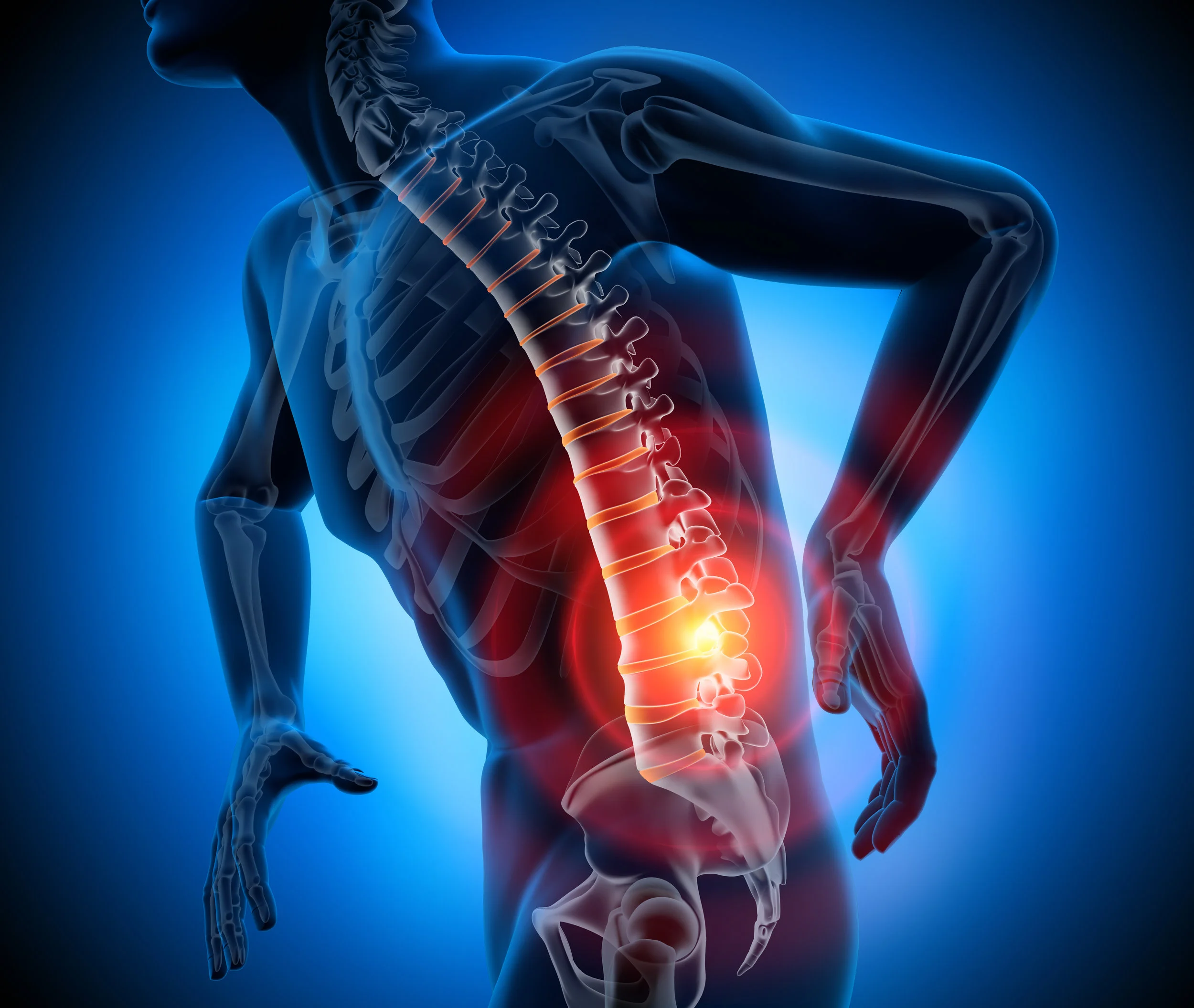PainLowerBackSpine.jpeg