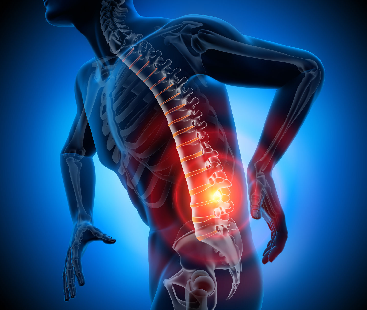 Demystifying Lumbar Spinal Stenosis: Understanding Your Back Pain In NJ -  Performance Rehabilitation