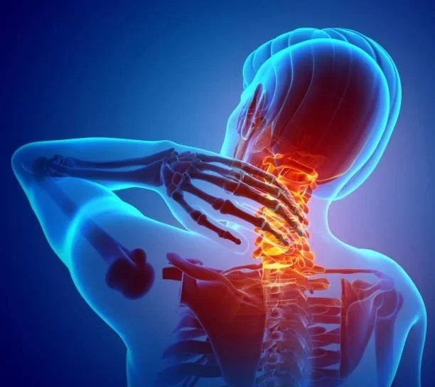 Anatomical graphic of the cervical spine highlighting a neck injury treated at Indy Spine and Rehab in Carmel, Indiana.
