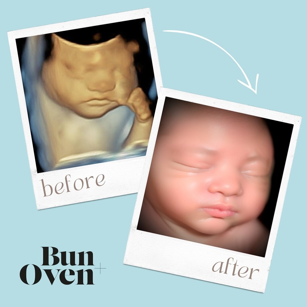 Announcing our newest obsession: 8K ULTRASOUND PHOTOS ❣️🤩 📷

Bringing you the most realistic image of your baby yet! 🥹

Now available to all clients! 🌸

&bull;
&bull;
&bull;
&bull;
#pregnancy #pregnantbelly #pregnant #fyp #pregnancyannouncement #