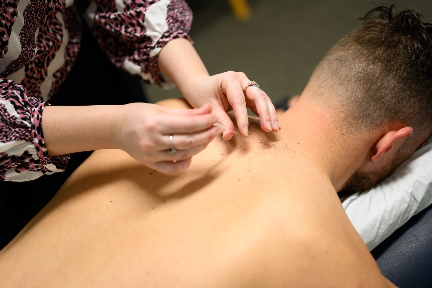 Acupuncture has been growing in popularity with the general community. It is a safe, regulated practice that can work well as an adjunct to a range of medical treatments. 🌱

We may be able to assist with:

◾ painful, post-surgical musculoskeletal co