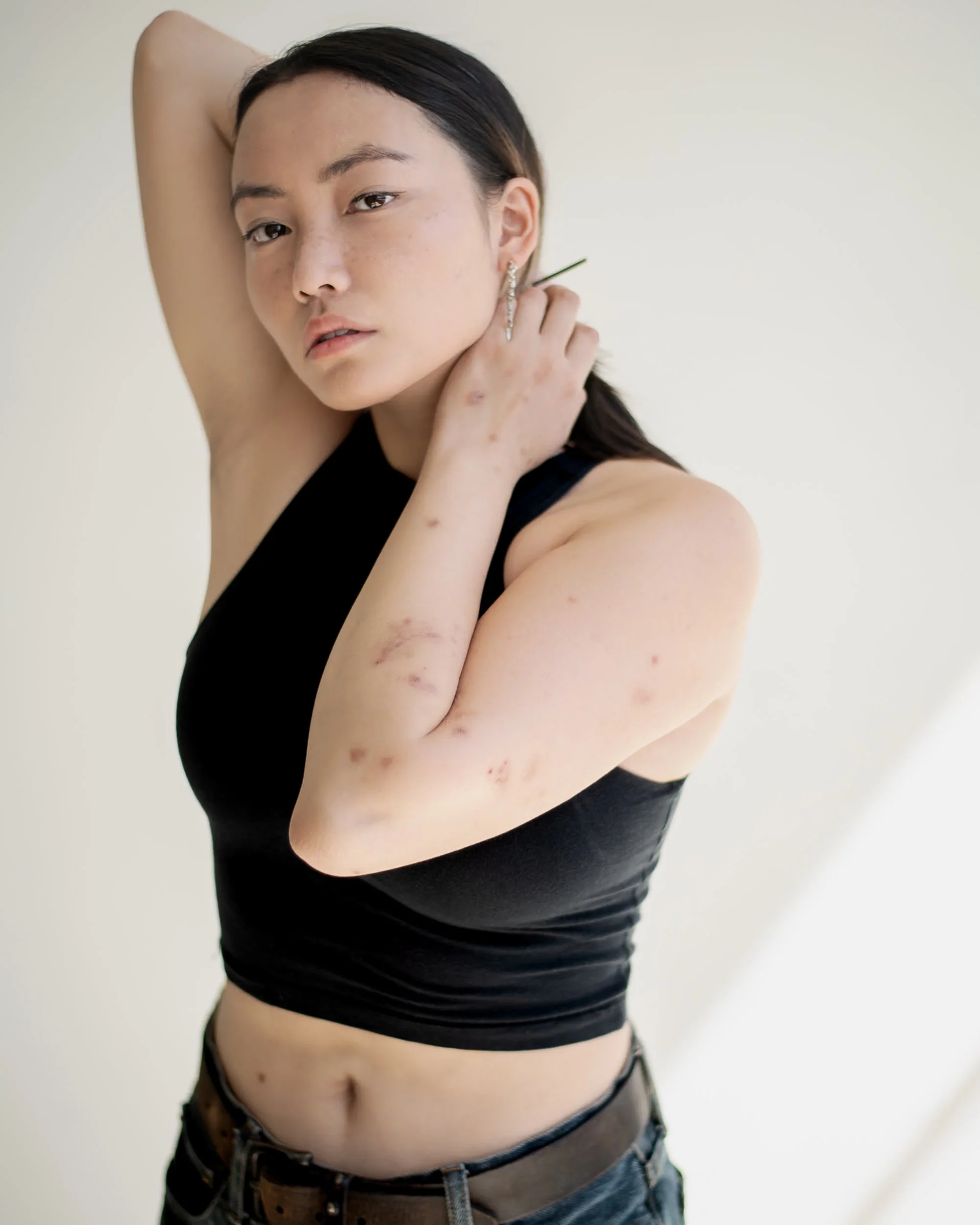 Young woman with dark hair, wearing a black sleeveless top and jeans, standing against a plain background, with several scars and acne on her arms and torso, photographed during a portrait photography session in Los Angeles with fashion photographer 