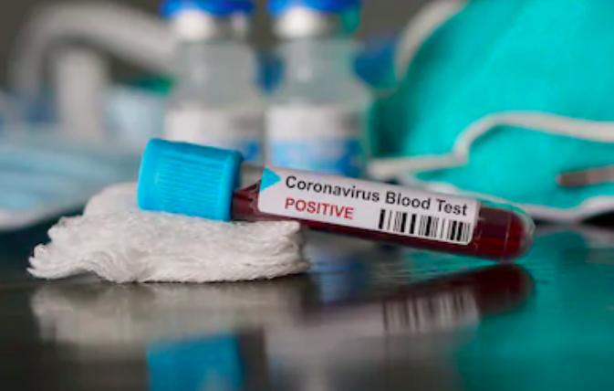 Testing for coronavirus: different realities