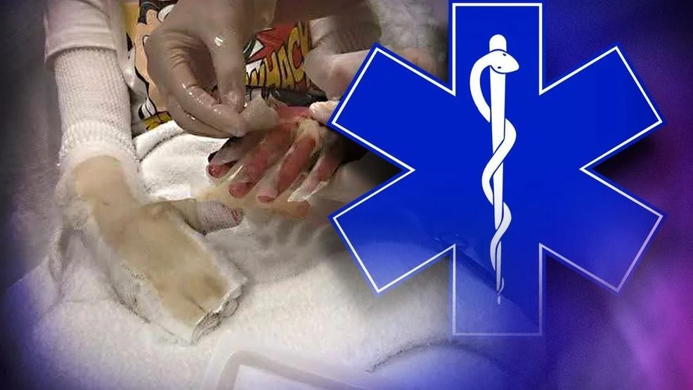 Hartsville worker burned in workplace accident.jpg