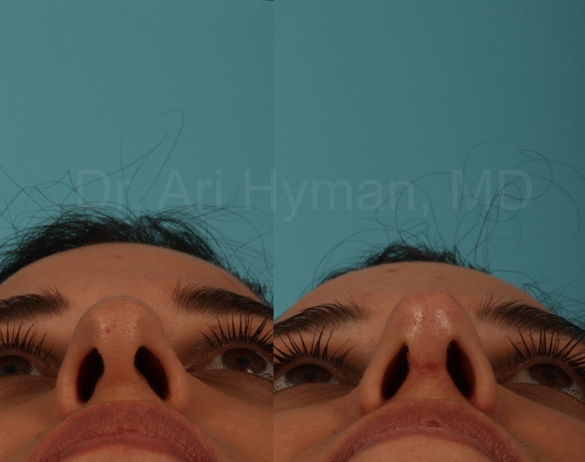 9C1DC423-6062-4A05-BD1B-38EB13B62B51.jpeg